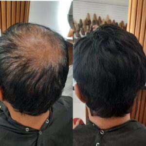 Human hair wig styled at RZ Wigs Australia, Cheltenham